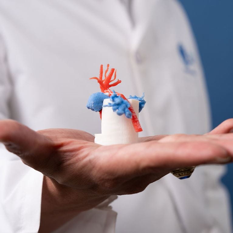 Dr Angtuaco in studio holding 3d model of infant heart.