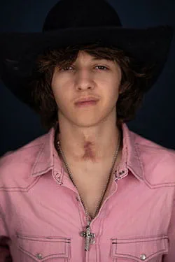 Arkansas Children's teenage ENT patient with trach scar. 